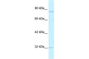 WB Suggested Anti-BRD2 Antibody Titration:  2. (BRD2 anticorps  (C-Term))