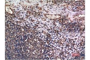 Immunohistochemical analysis of paraffin-embedded Human Tonsil Tissue using Cyclin B1 Mouse mAb diluted at 1:200.