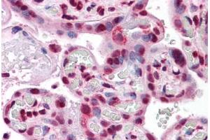 Human Placenta: Formalin-Fixed, Paraffin-Embedded (FFPE)