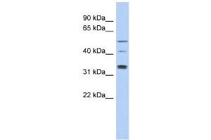 TCP11 antibody used at 1 ug/ml to detect target protein.