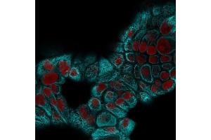Confocal immunofluorescence image of MCF-7 cells using Cytokeratin 15 Mouse Monoclonal Antibody (KRT15/2959) followed by Goat anti-Mouse CF488 (Cyan) and Reddot is used to label the nuclei Red.