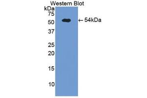 Detection of Recombinant SELE, Porcine using Polyclonal Antibody to E-selectin (Selectin E/CD62e anticorps  (AA 260-420))