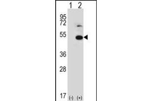 Western blot analysis of TRIP13 (arrow) using rabbit polyclonal TRIP13 Antibody (N-term) (ABIN389357 and ABIN2839463). (TRIP13 anticorps  (N-Term))