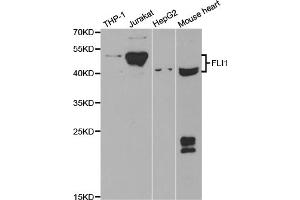 Western blot analysis of extracts of various cell lines, using FLI1 antibody. (FLI1 anticorps)