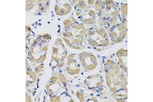 Immunohistochemistry of paraffin-embedded human stomach using PSPH antibody. (PSPH anticorps  (AA 1-225))