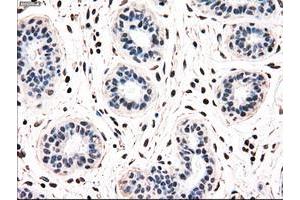 Image no. 3 for anti-Nuclear Receptor Binding Protein 1 (NRBP1) antibody (ABIN1499822)