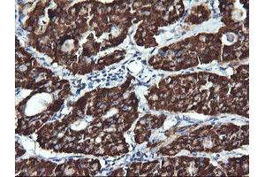 Immunohistochemistry (IHC) image for anti-Acetyl-CoA Acyltransferase 2 (ACAA2) antibody (ABIN1495726)