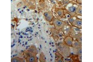 IHC-P analysis of Liver tissue, with DAB staining. (Interferon gamma anticorps  (AA 24-166))