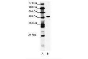 Image no. 1 for anti-Zinc Finger Protein 541 (ZNF541) (AA 783-832) antibody (ABIN203199) (ZNF541 anticorps  (AA 783-832))