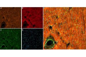 ATX-II co-localizes with NaV1.