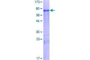 Image no. 1 for Phospholipase B (PLB) (AA 1-488) protein (GST tag) (ABIN1326591)