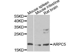 Western blot analysis of extracts of various cell lines, using ARPC5 antibody (ABIN5996446) at 1/1000 dilution.