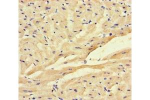 Immunohistochemistry of paraffin-embedded human heart tissue using ABIN7153010 at dilution of 1:100 (FSTL1 anticorps  (AA 176-285))