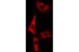 ABIN6279421 staining A549 cells by IF/ICC.