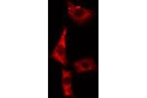 ABIN6279421 staining A549 cells by IF/ICC. (EIF3S1 anticorps  (Internal Region))