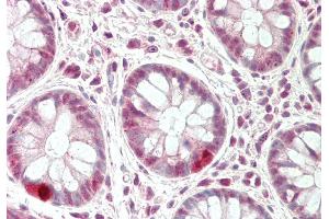 Rabbit Anti-CXXC1 antibody  Formalin Fixed Paraffin Embedded Tissue: Human Colon Primary antibody Concentration: 1:100 Secondary Antibody: Donkey anti-Rabbit-Cy3 Secondary Antibody Concentration: 1:200 Magnification: 20x Exposure Time: 0. (CXXC1 anticorps  (Middle Region))