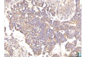 IHC analysis of EIF4B using anti-EIF4B antibody (ABIN7599496).