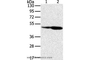 Western blot analysis of Hepg2 and hela cell, using SNX8 Polyclonal Antibody at dilution of 1:400 (SNX8 anticorps)
