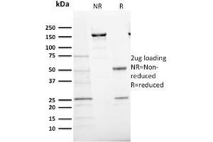 SDS-PAGE Analysis Purified Ki67 Mouse Monoclonal Antibody (MKI67/2466). (Ki-67 anticorps  (AA 2293-2478))