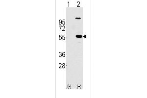 Western blot analysis of ALDH1A1 using rabbit polyclonal ALDH1A1 Antibody using 293 cell lysates (2 ug/lane) either nontransfected (Lane 1) or transiently transfected with the ALDH1A1 gene (Lane 2). (ALDH1A1 anticorps  (AA 302-331))