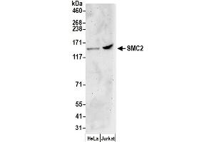 Western Blotting (WB) image for anti-Structural Maintenance of Chromosomes 2 (SMC2) (AA 950-1000) antibody (ABIN7449170) (SMC2 anticorps  (AA 950-1000))