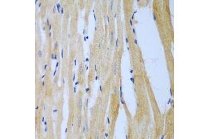Immunohistochemistry of paraffin-embedded rat heart using MGAT3 antibody.