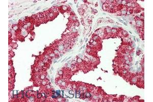 IHC-P analysis of Human Prostate Gland Tissue, with HE staining. (CPT1A anticorps  (AA 191-353))