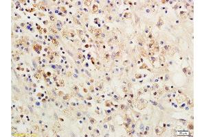Formalin-fixed and paraffin embedded: rat brain tissue labeled with Anti-SOCS 1 Polyclonal Antibody , Unconjugated 1:200 followed by conjugation to the secondary antibody and DAB staining (SOCS1 anticorps  (AA 121-211))