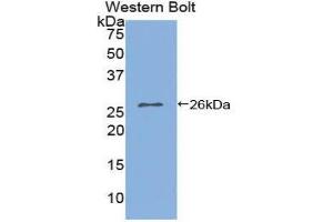 Western Blotting (WB) image for anti-Interleukin 2 Receptor, alpha (IL2RA) (AA 22-213) antibody (ABIN1859412) (CD25 anticorps  (AA 22-213))