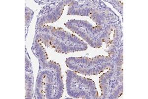 Immunohistochemical staining (Formalin-fixed paraffin-embedded sections) of human fallopian tube with DLEC1 polyclonal antibody  shows strong positivity of cilia.