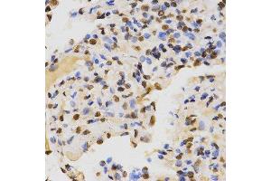 Immunohistochemistry of paraffin-embedded human lung using DiMethyl-Histone H3-K36 antibody.