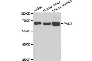 Western blot analysis of extracts of various cell lines, using PAK2 antibody. (PAK2 anticorps)