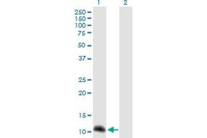 Western Blot analysis of NPHP1 expression in transfected 293T cell line by NPHP1 MaxPab polyclonal antibody. (NPHP1 anticorps  (AA 1-121))