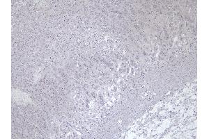 (ABIN570915) Negative Control showing staining of paraffin embedded Human Adrenal Gland, with no primary antibody.