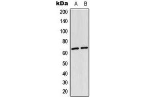 Western blot analysis of NF-kappaB p65 (AcK310) expression in HeLa (A), mouse lung (B) whole cell lysates. (NF-kB p65 anticorps  (acLys310))
