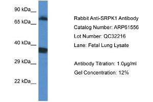 Western Blotting (WB) image for anti-SRSF Protein Kinase 1 (SRPK1) (C-Term) antibody (ABIN2788838) (SRPK1 anticorps  (C-Term))