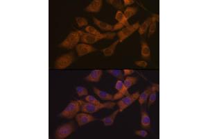 Immunofluorescence analysis of NIH-3T3 cells using KIF3A Rabbit mAb (ABIN7268132) at dilution of 1:100 (40x lens). (KIF3A anticorps)