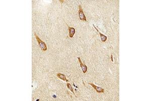 Immunohistochemical analysis of raffin-embedded H.