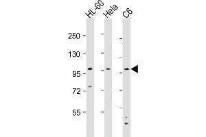 All lanes : Anti-NCSTN Antibody (N-Term) at 1:8000 dilution Lane 1: HL-60 whole cell lysates Lane 2: Hela whole cell lysates Lane 3: C6 whole cell lysates Lysates/proteins at 20 μg per lane. (Nicastrin anticorps  (AA 99-133))