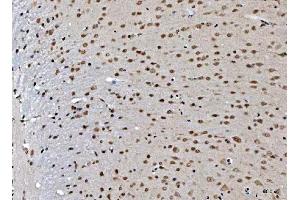 IHC analysis of THAP11 using anti-THAP11 antibody (ABIN7599230). (THAP11 anticorps  (AA 1-294))