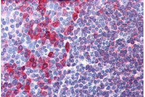 Human Tonsil: Formalin-Fixed, Paraffin-Embedded (FFPE) (CD79a anticorps  (AA 202-216))