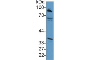 Detection of CPT1A in Human Hela cell lysate using Polyclonal Antibody to Carnitine Palmitoyltransferase 1A, Liver (CPT1A)