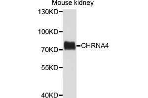 Western blot analysis of extracts of mouse kidney, using CHRNA4 antibody. (CHRNA4 anticorps)