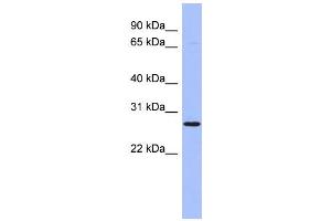 WB Suggested Anti-HOXA6 Antibody Titration:  0. (HOXA6 anticorps  (Middle Region))