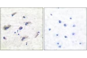 Immunohistochemistry analysis of paraffin-embedded human brain, using Tau (Phospho-Ser356) Antibody. (tau anticorps  (pSer673))