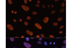 Immunofluorescence analysis of U-2 OS cells using HDGF Polyclonal Antibody at dilution of 1:100. (HDGF anticorps)