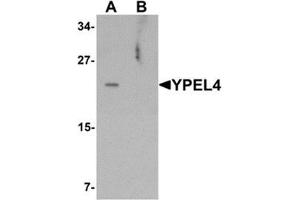 Western blot analysis of YPEL4 in SW480 cell lysate with YPEL4 antibody at 1 ug/mL in (A) the absence and (B) the presence of blocking peptide. (YPEL4 anticorps  (N-Term))