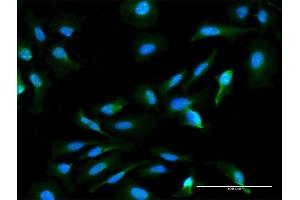 Immunofluorescence of monoclonal antibody to HN1L on HeLa cell. (HN1L anticorps  (AA 1-190))