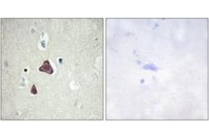 Immunohistochemistry (IHC) image for anti-Adenylate Cyclase 8 (Brain) (ADCY8) (AA 591-640) antibody (ABIN2889854)