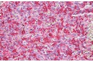 Human Spleen, Macrophages: Formalin-Fixed, Paraffin-Embedded (FFPE)